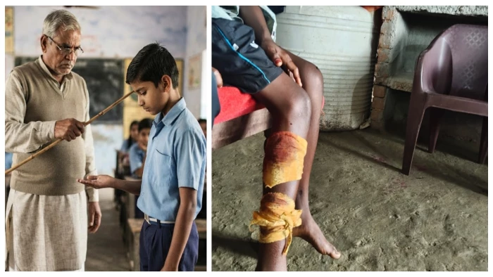 प्राथमिक स्कूल में छात्र की पिटाई का आरोप, पहाड़ी कोरवा बच्चे के साथ मारपीट से मचा हड़कंप